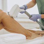 Depilação a Laser no Inverno: Menor exposição solar garante resultados mais eficientes